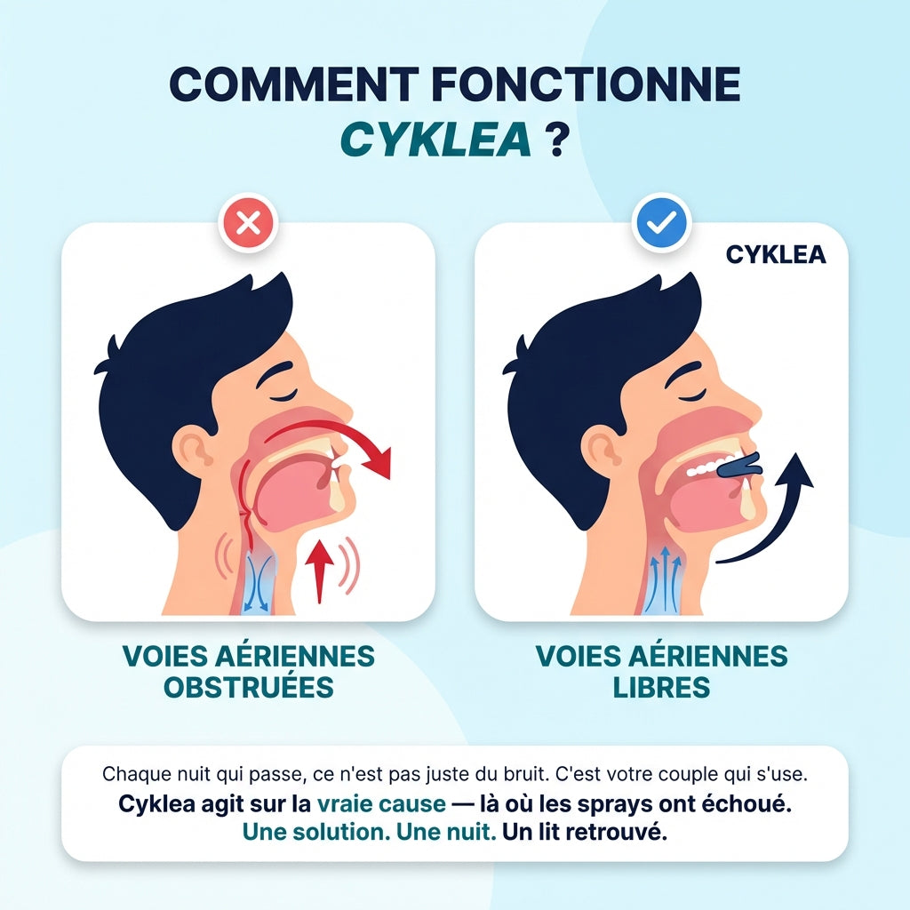 Cyklea™ OrthoSleep - Gouttière anti ronflement