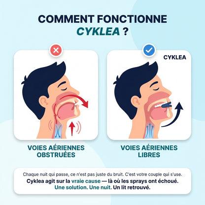 Cyklea™ OrthoSleep - Gouttière anti ronflement